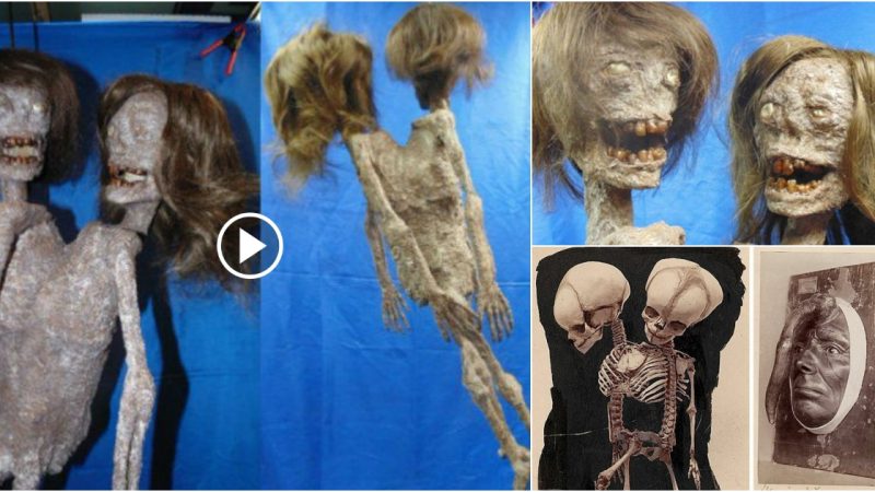 The discovery of the remains of the “Two Headed Monster” with hair and teeth stunned scientists.