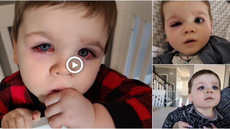 Mother in USA issues warning after child nearly lost his sight because of bath toys