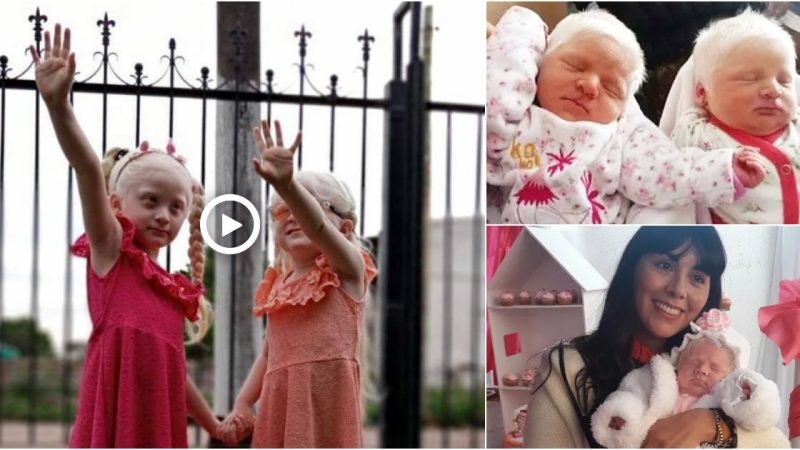 She had albino twins with snow-white hair. Take a look at how they’ve changed…