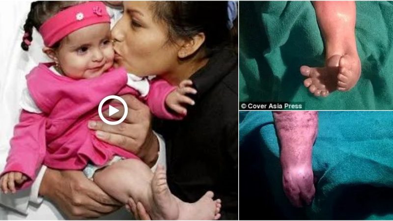 Speculation is swirling as many people believe that this newborn in India might be the country’s first-ever mermaid