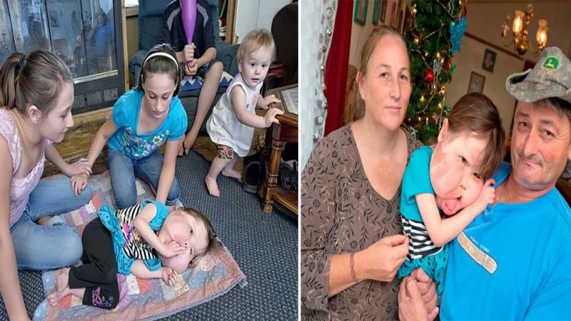 4-year-old girl with rare deformity undergoes many surgeries for the first time and is always the best companion of her parents