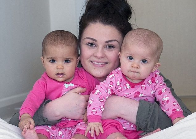 “One-in-a-Million” Twins: Meet the Girls Born with Different Colored Skin