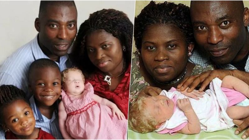 “Remarkable Birth: Nigerian Couple Welcomes Baby Girl with Unusual Skin Color”