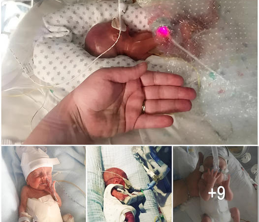 Tiny Fighter: The Incredible Journey of a 22-Week-Old Preemie