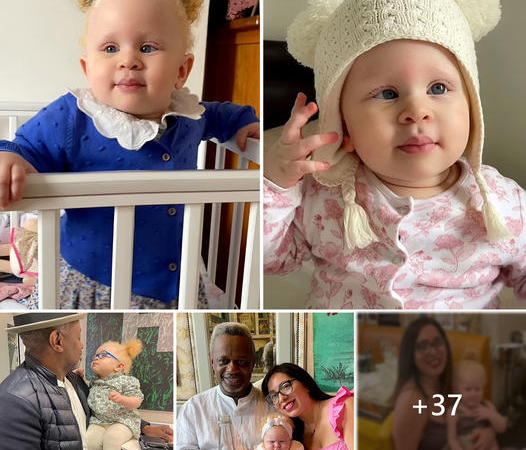 Confronting Racial Abuse: White Mother and Black Father Raise Baby with Albinism