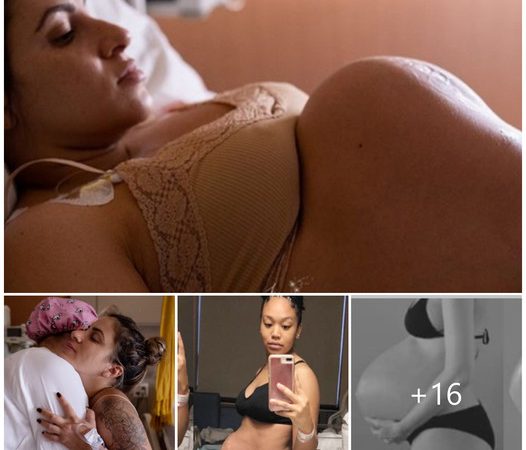 Capturing the Resilience of a Woman’s Body During Childbirth