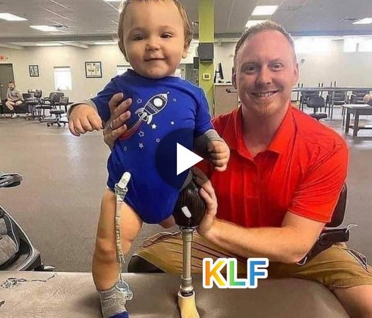 Crafting a Lightweight and Flexible Prosthetic for His Son Using Wood and Metal