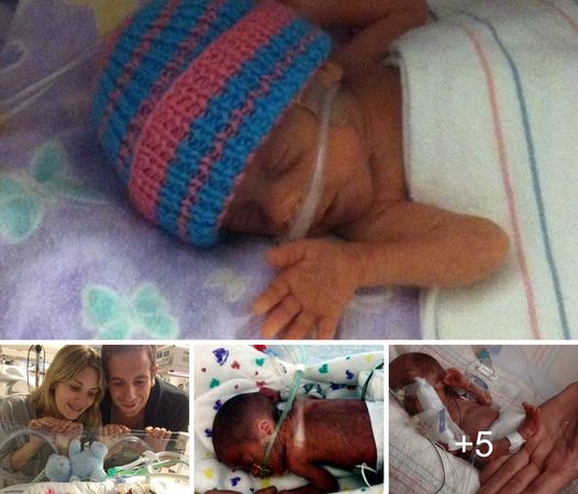 Stories of Triumph and Survival Among Premature Babies