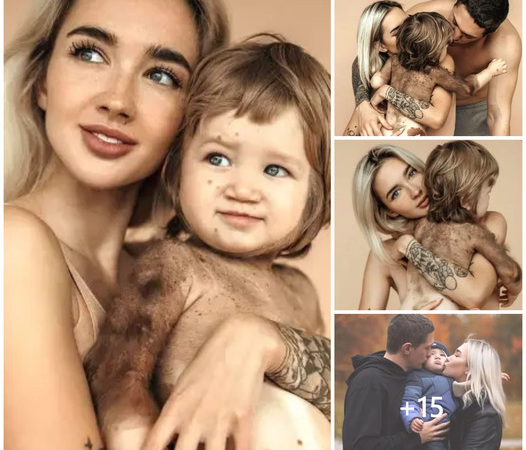 Model Ekaterina Mezenova Reveals Her 1-Year-Old Son’s Rare Skin Condition, Leaving Followers Astonished