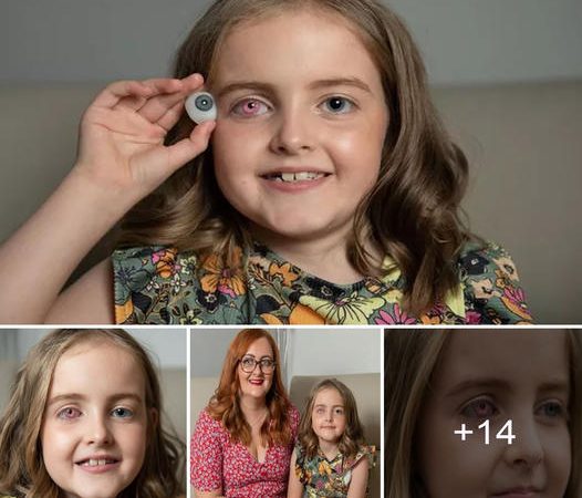 8-Year-Old Girl Triumphs Over Rare Cancer and Possesses Beautiful ‘Superhero’ Eyes