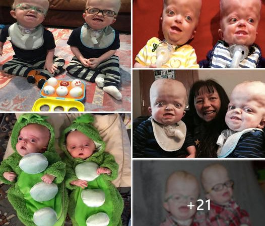 Linda Trepanier: A Nurse’s Compassionate Embrace of Twin Boys with Disabilities