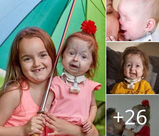 The Extraordinary Story of Isla: A Two-Year-Old Girl with a Unique Genetic Condition