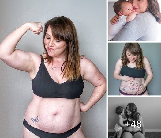 Empowering Moms: Inspiring Woman Embraces Post-Baby Stretch Marks to Promote Body Positivity