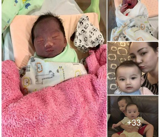 Boy’s Rare Birth Color Startles Mother, Astonishing Transformation Unfolds in Two Years