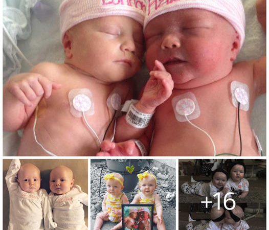 A Mother’s Inspiring Journey Amidst Identical Twin Challenges