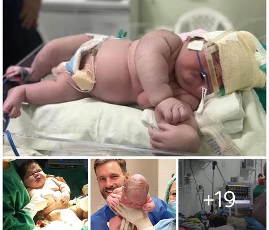 Online Community Amazed by Woman Giving Birth to 7.3 kg Baby While Carrying Baby Clothes for Four Months