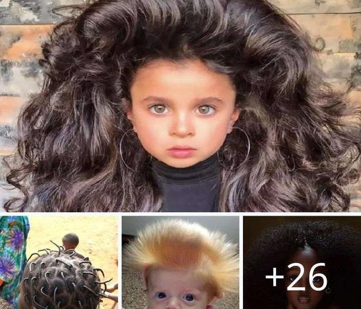 Social Media Buzz: The Enchanting Hair of Babies with Uncombable Hair Syndrome