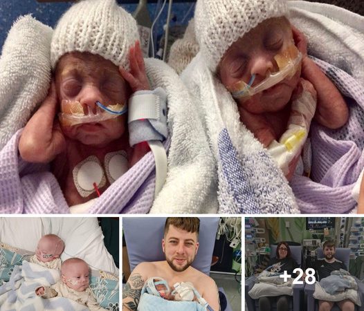 Miraculous Reunion: Preemie Twins Defy the Odds, Born at 24 Weeks, Return Home After 150 Days