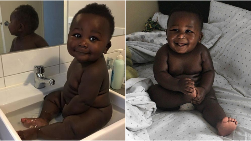 Radiant Diversity: Challenging Beauty Norms Through the World’s Blackest Boy